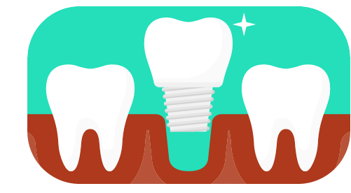 Próteses dentárias exigem cuidados especiais, especialmente se forem definitivas. Exames bucais devem ser realizados ao menos uma vez por ano e é necessário seguir rigorosamente as orientações passada pelo seu dentista;