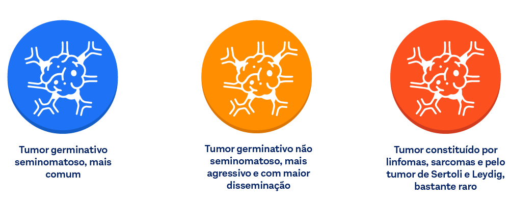 Tumor germinativo seminomatoso, mais comum; Tumor germinativo não seminomatoso, mais agressivo e com maior disseminação; Tumor constituído por linfomas, sarcomas e pelo tumor de Sertoli e Leydig, bastante raro.