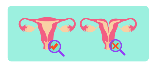 Dismenorreia secundária: cólicas que se relacionam a malformações uterinas, endométrios, miomas, uso de dispositivo intrauterino (DIU).